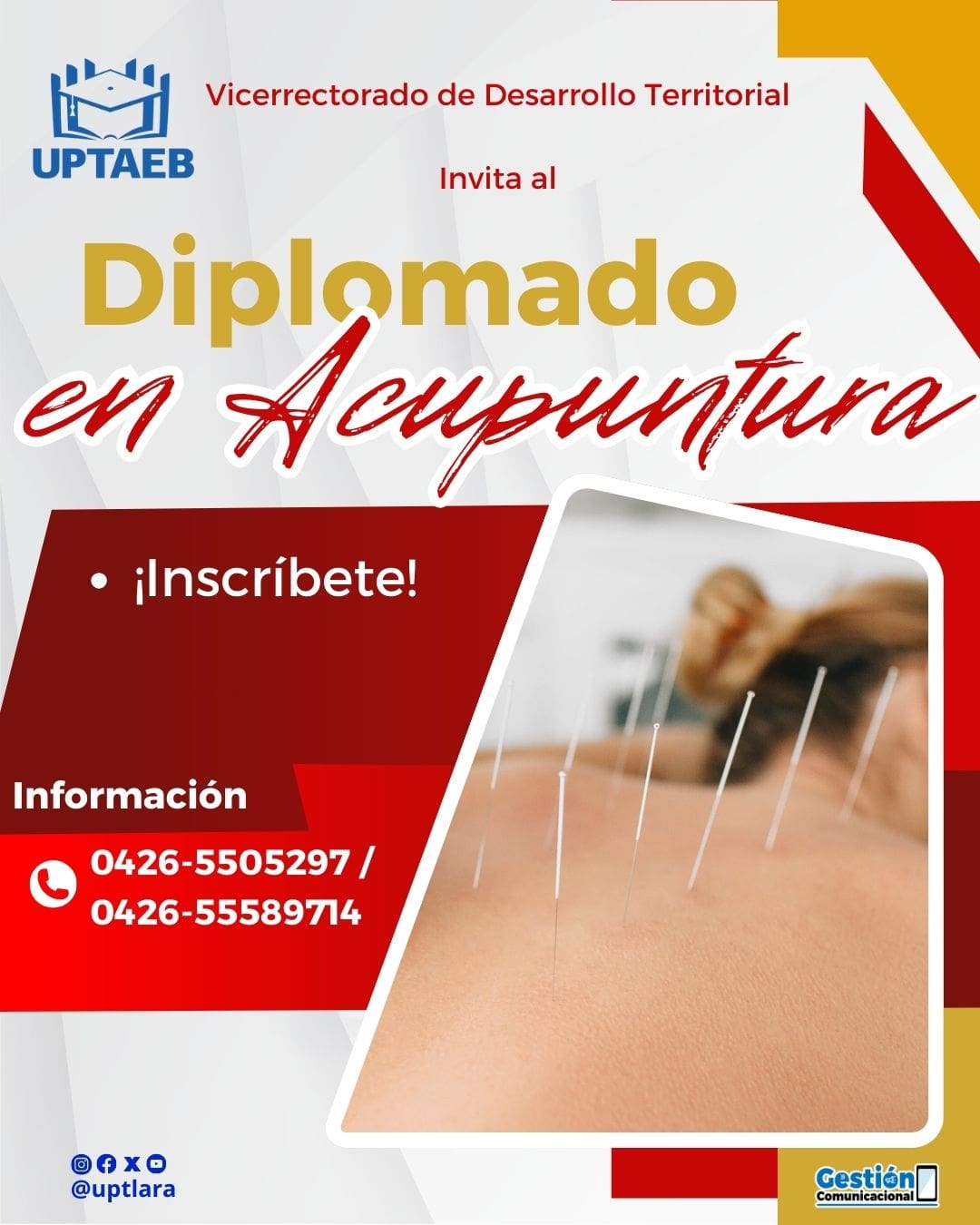Diplomado en Acupuntura